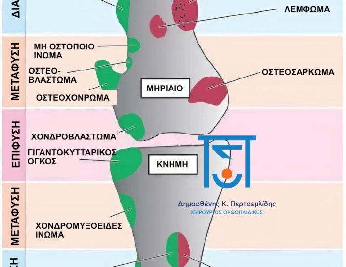 ΕΝΤΟΠΙΣΕΙΣ ΟΓΚΩΝ