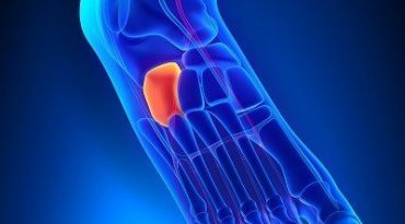 Σύνδρομο κυβοειδούς