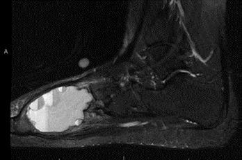 Εικόνα που περιέχει ασπρόμαυρο, μαύρο, μονοχρωματικό, μονοχρωματική φωτογραφία
Το περιεχόμενο που δημιουργείται από AI ενδέχεται να είναι εσφαλμένο.