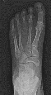 Εικόνα που περιέχει φιλμ ακτινογραφίας, ιατρική απεικόνιση, ιατρικό, ακτινογραφία
Το περιεχόμενο που δημιουργείται από AI ενδέχεται να είναι εσφαλμένο.