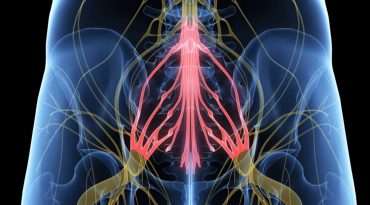 Σύνδρομο ιππουρίδας