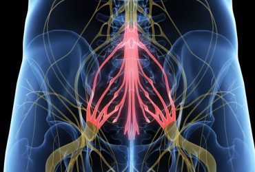 Σύνδρομο ιππουρίδας