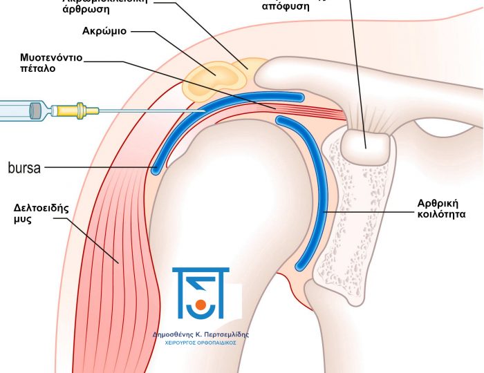 Ανατομία ώμου