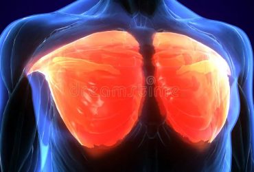 Ρήξη μείζονα θωρακικού μυ