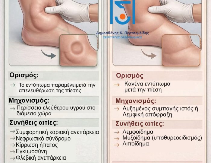 Οίδημα αστραγάλου
