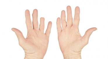 Τραυματισμοί και ακρωτηριασμοί στα δάχτυλα