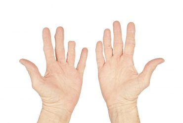 Τραυματισμοί και ακρωτηριασμοί στα δάχτυλα